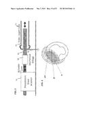 AUTO-TUNE-AND-MATCH COILS FOR HUMAN WHOLE-BODY IMAGING AND METHOD diagram and image