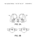 BINAURAL HEARING ASSISTANCE SYSTEM COMPRISING TWO WIRELESS INTERFACES diagram and image