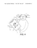 BINAURAL HEARING ASSISTANCE SYSTEM COMPRISING TWO WIRELESS INTERFACES diagram and image