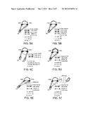 BINAURAL HEARING ASSISTANCE SYSTEM COMPRISING TWO WIRELESS INTERFACES diagram and image