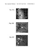 RETINAL PIGMENT EPITHELIAL CELLS DIFFERENTIATED FROM EMBRYONIC STEM CELLS     WITH NICOTINAMIDE AND ACTIVIN A diagram and image