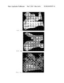 BONE FILLER MATERIAL AND METHODS OF USE diagram and image