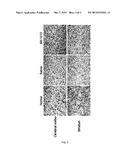 Pharmaceutical Composition or Health Food Comprising Lonicera Coerulea     Var. Edulis Fruit Extracts as Active Ingredients for Preventing or     Improving Ischemic Cerebrovascular Diseases diagram and image