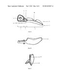 DENTAL WEDGE WITH ASYMMETRIC SIDES diagram and image