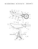 DENTAL WEDGE WITH ASYMMETRIC SIDES diagram and image