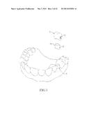 SPRING CLIP MOUNTED TO WITHDRAWABLE ARTIFICIAL TOOTH AND REMOVABLE     ARTIFICIAL TOOTH ASSEMBLED WITH SAME diagram and image