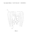 SPRING CLIP MOUNTED TO WITHDRAWABLE ARTIFICIAL TOOTH AND REMOVABLE     ARTIFICIAL TOOTH ASSEMBLED WITH SAME diagram and image