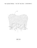 SPRING CLIP MOUNTED TO WITHDRAWABLE ARTIFICIAL TOOTH AND REMOVABLE     ARTIFICIAL TOOTH ASSEMBLED WITH SAME diagram and image