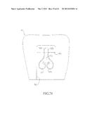 SPRING CLIP MOUNTED TO WITHDRAWABLE ARTIFICIAL TOOTH AND REMOVABLE     ARTIFICIAL TOOTH ASSEMBLED WITH SAME diagram and image