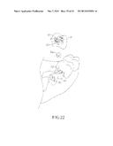 SPRING CLIP MOUNTED TO WITHDRAWABLE ARTIFICIAL TOOTH AND REMOVABLE     ARTIFICIAL TOOTH ASSEMBLED WITH SAME diagram and image