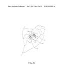 SPRING CLIP MOUNTED TO WITHDRAWABLE ARTIFICIAL TOOTH AND REMOVABLE     ARTIFICIAL TOOTH ASSEMBLED WITH SAME diagram and image