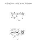 Additional Methods and Devices for Improving the Performance of CVTs diagram and image