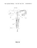 DEVICE FOR STRENGTHENING PELVIC FLOOR MUSCULATURE IN WOMEN diagram and image