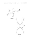 DEVICE FOR STRENGTHENING PELVIC FLOOR MUSCULATURE IN WOMEN diagram and image