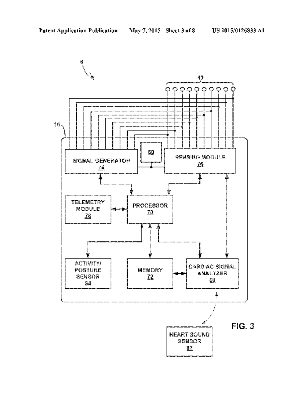 TECHNIQUES FOR MITIGATING MOTION ARTIFACTS FROM IMPLANTABLE PHYSIOLOGICAL     SENSORS - diagram, schematic, and image 04