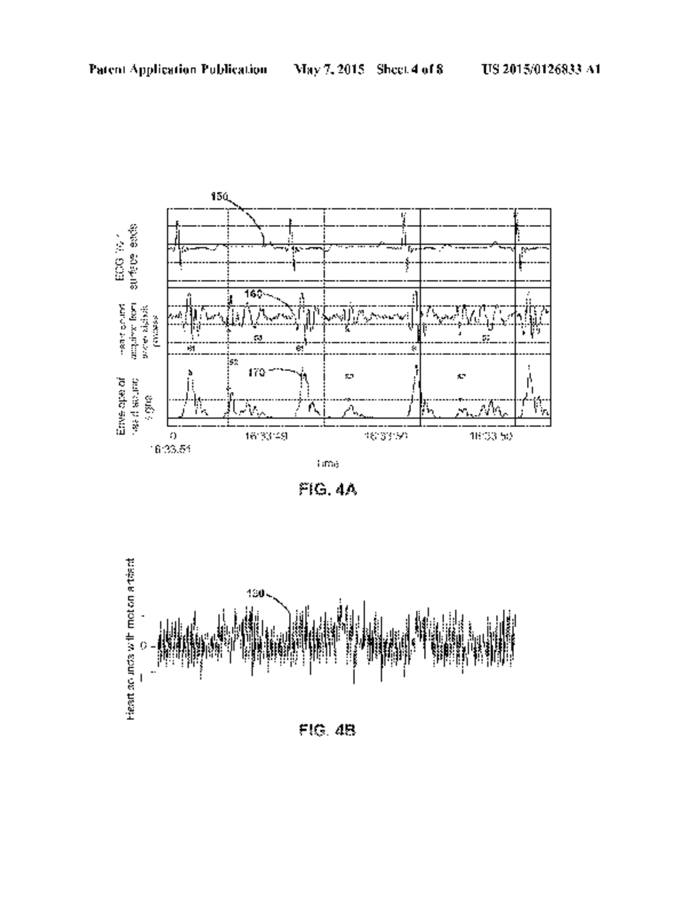 TECHNIQUES FOR MITIGATING MOTION ARTIFACTS FROM IMPLANTABLE PHYSIOLOGICAL     SENSORS - diagram, schematic, and image 05