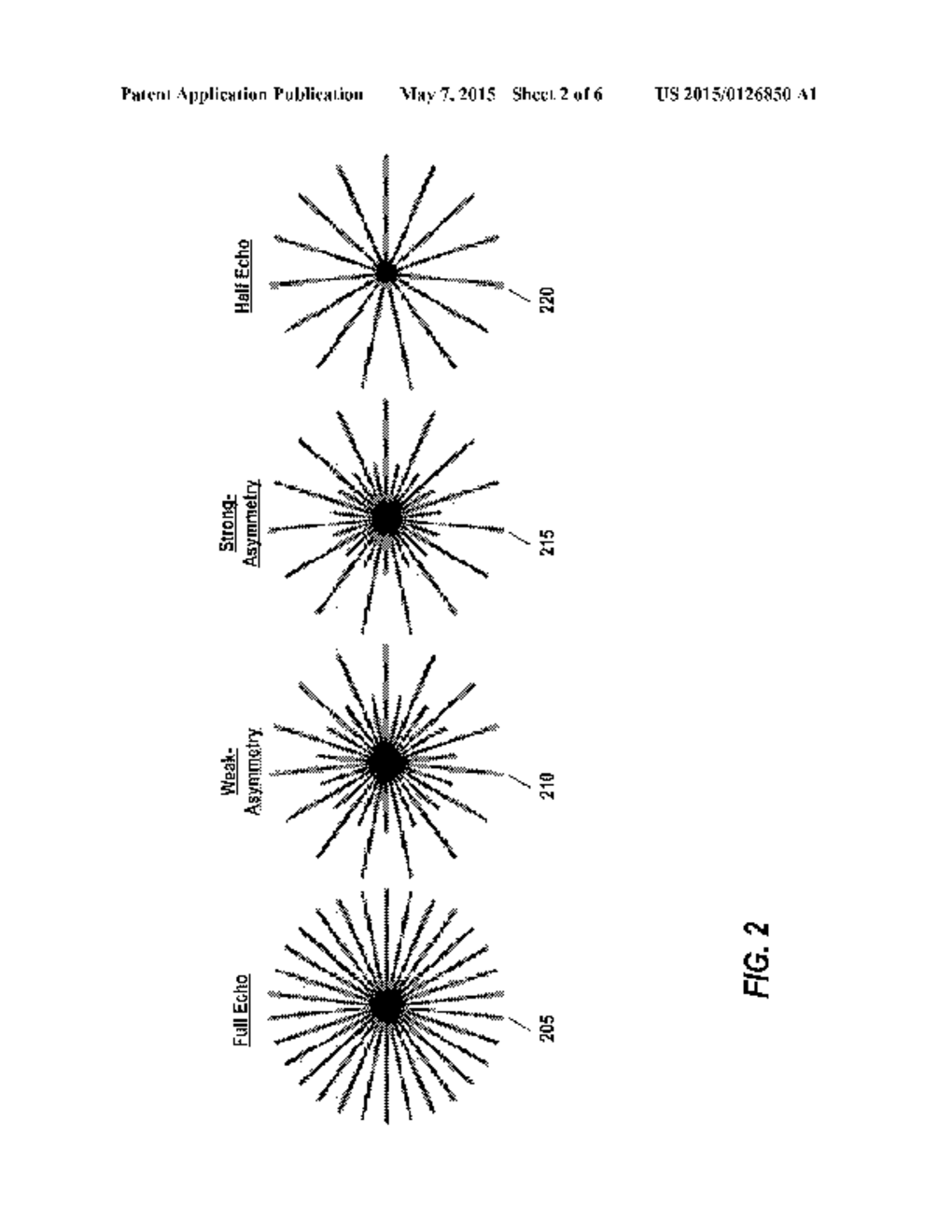 Magnetic Resonance Imaging with Asymmetric Radial Sampling and     Compressed-Sensing Reconstruction - diagram, schematic, and image 03