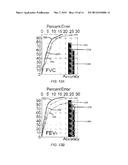 SOUND-BASED SPIROMETRIC DEVICES, SYSTEMS AND METHODS diagram and image