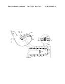 ELECTRICALLY TRANSPARENT CATHETER SHEATH diagram and image