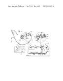 ELECTRICALLY TRANSPARENT CATHETER SHEATH diagram and image