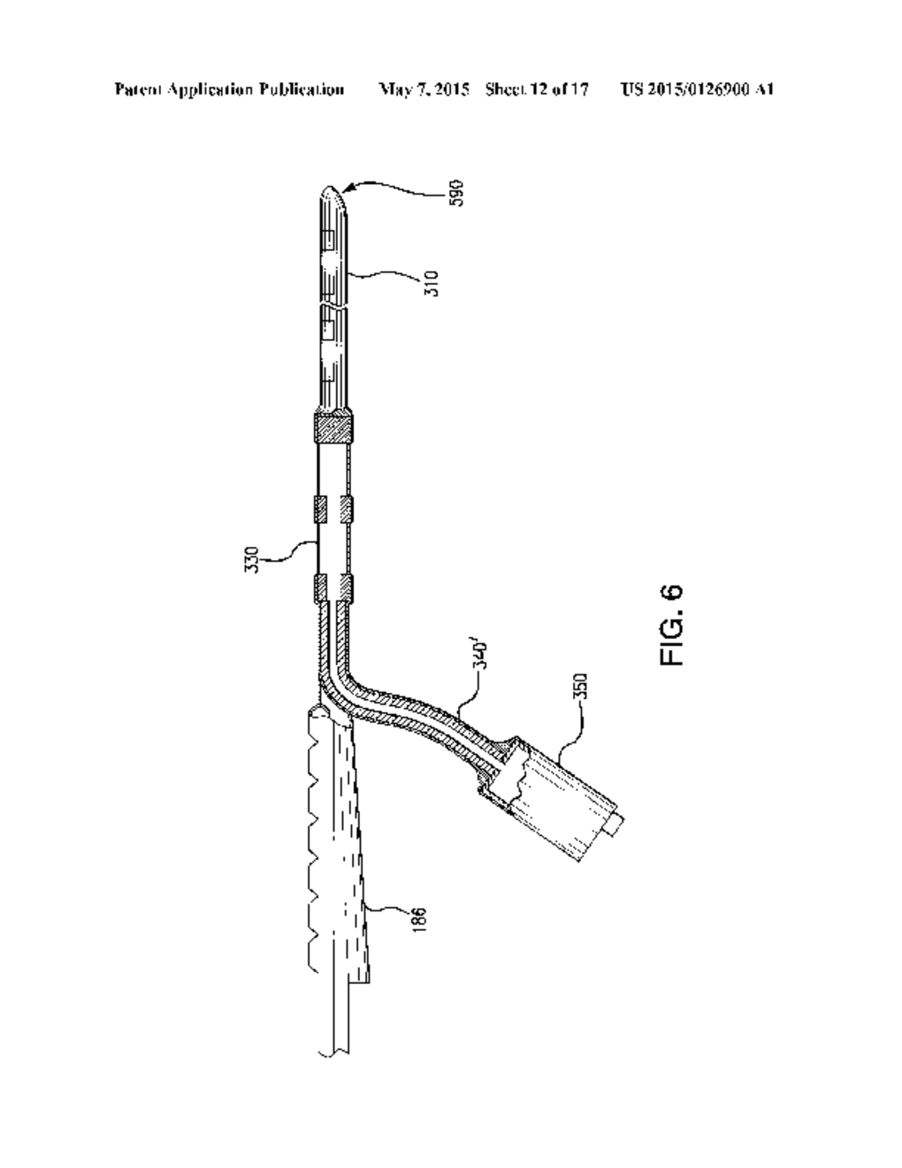 COCHLEAR IMPLANT ELECTRODE ARRAY INCLUDING RECEPTOR AND SENSOR - diagram, schematic, and image 13