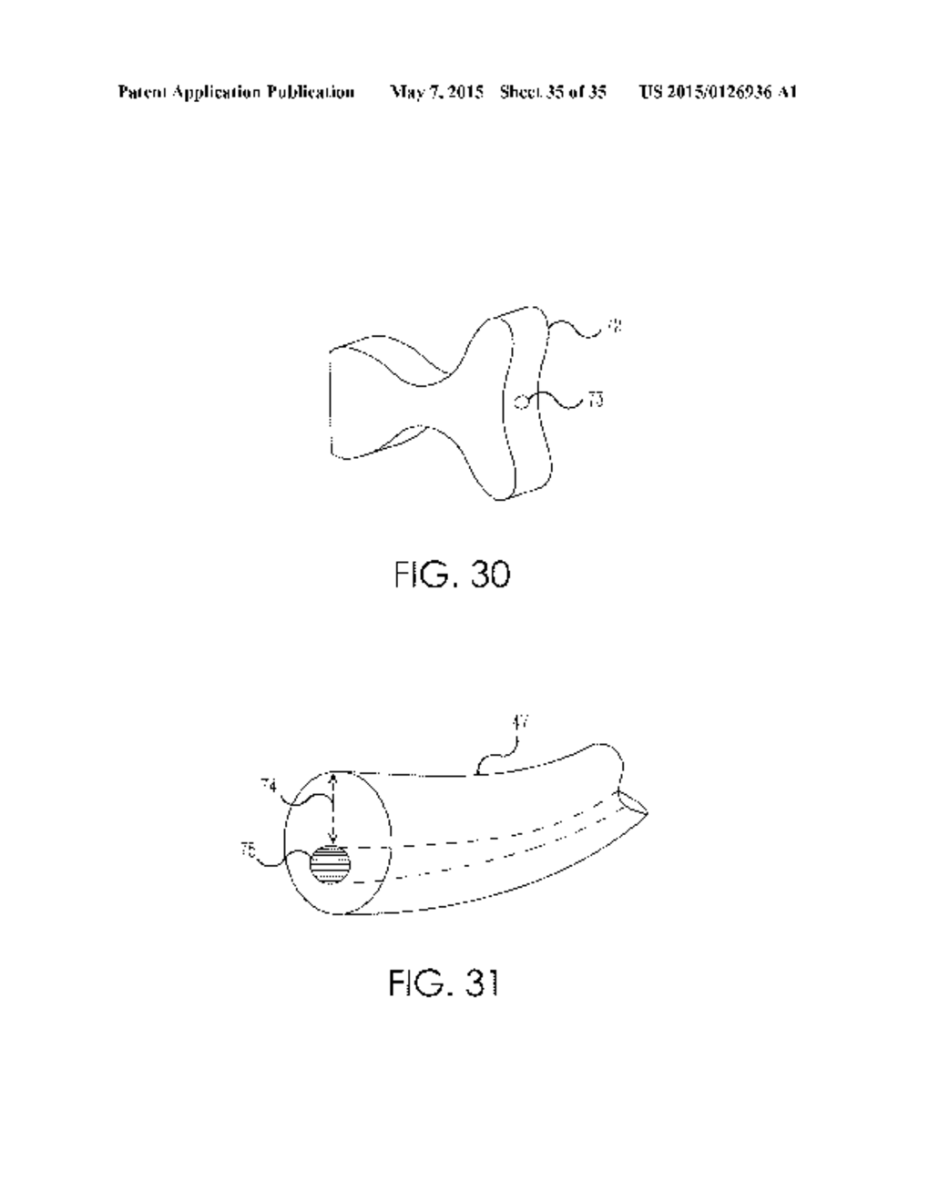 RETROGRADE ENTRY ANTEGRADE PLACEMENT FOR FEMORAL ARTERY ACCESS - diagram, schematic, and image 36