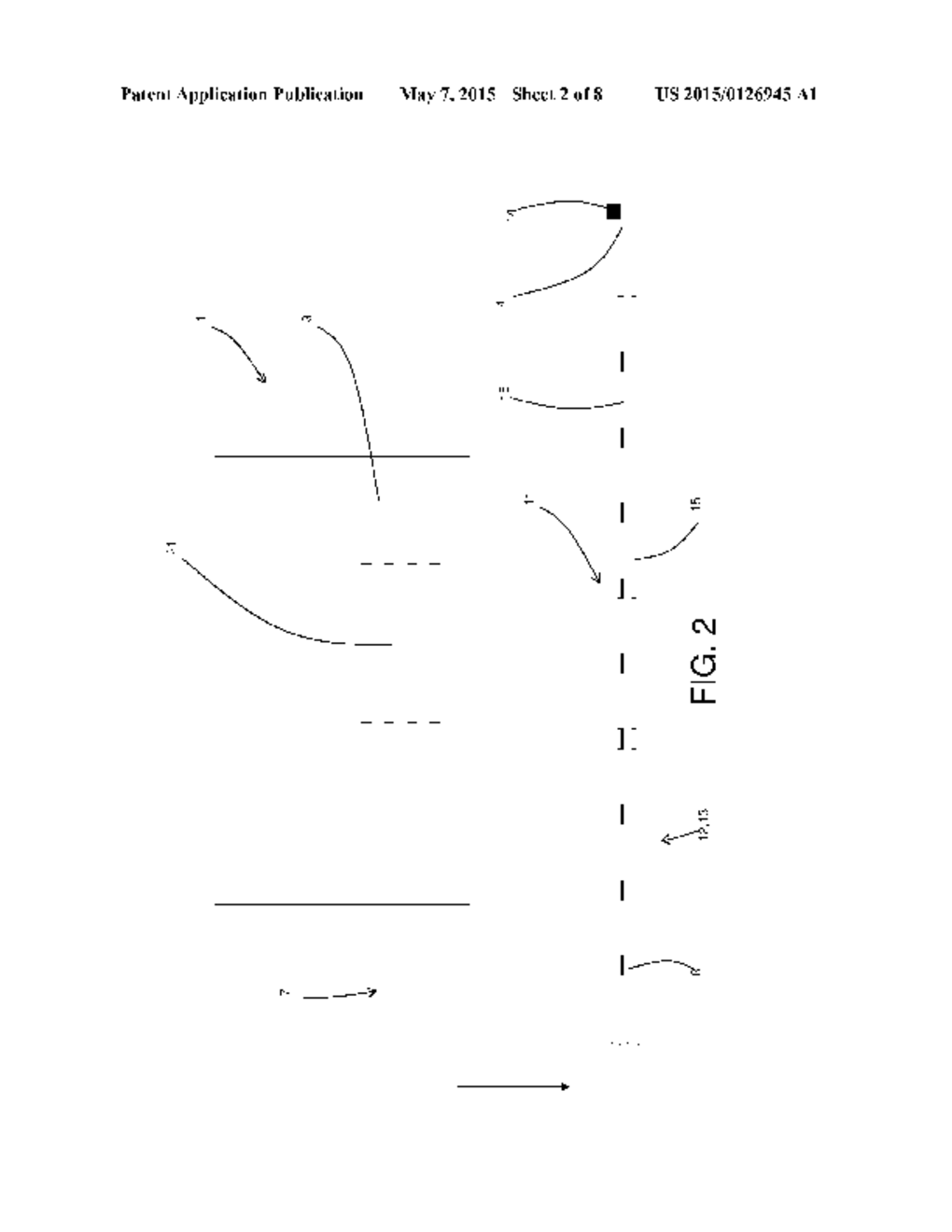 VITRECTOMY APPARATUS - diagram, schematic, and image 03