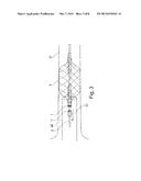 ASSEMBLY WITH A GUIDE TUBE, A FIXATOR FOR ATTACHING TO A BLOOD VESSEL, AND     A PUMP diagram and image