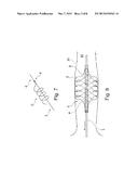 ASSEMBLY WITH A GUIDE TUBE, A FIXATOR FOR ATTACHING TO A BLOOD VESSEL, AND     A PUMP diagram and image