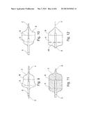 ASSEMBLY WITH A GUIDE TUBE, A FIXATOR FOR ATTACHING TO A BLOOD VESSEL, AND     A PUMP diagram and image