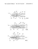 APPARATUS TO PREVENT REPERFUSION INJURY diagram and image