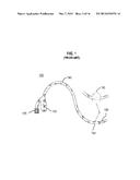 Ultraviolet Sterilizing Drainage Catheter diagram and image