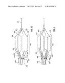 Apparatus and Methods Related to Constrained Deployment of Cryogenic     Balloons for Limited Cryogenic Abiation of Vessel Walls diagram and image