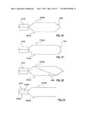 Apparatus and Methods Related to Constrained Deployment of Cryogenic     Balloons for Limited Cryogenic Abiation of Vessel Walls diagram and image