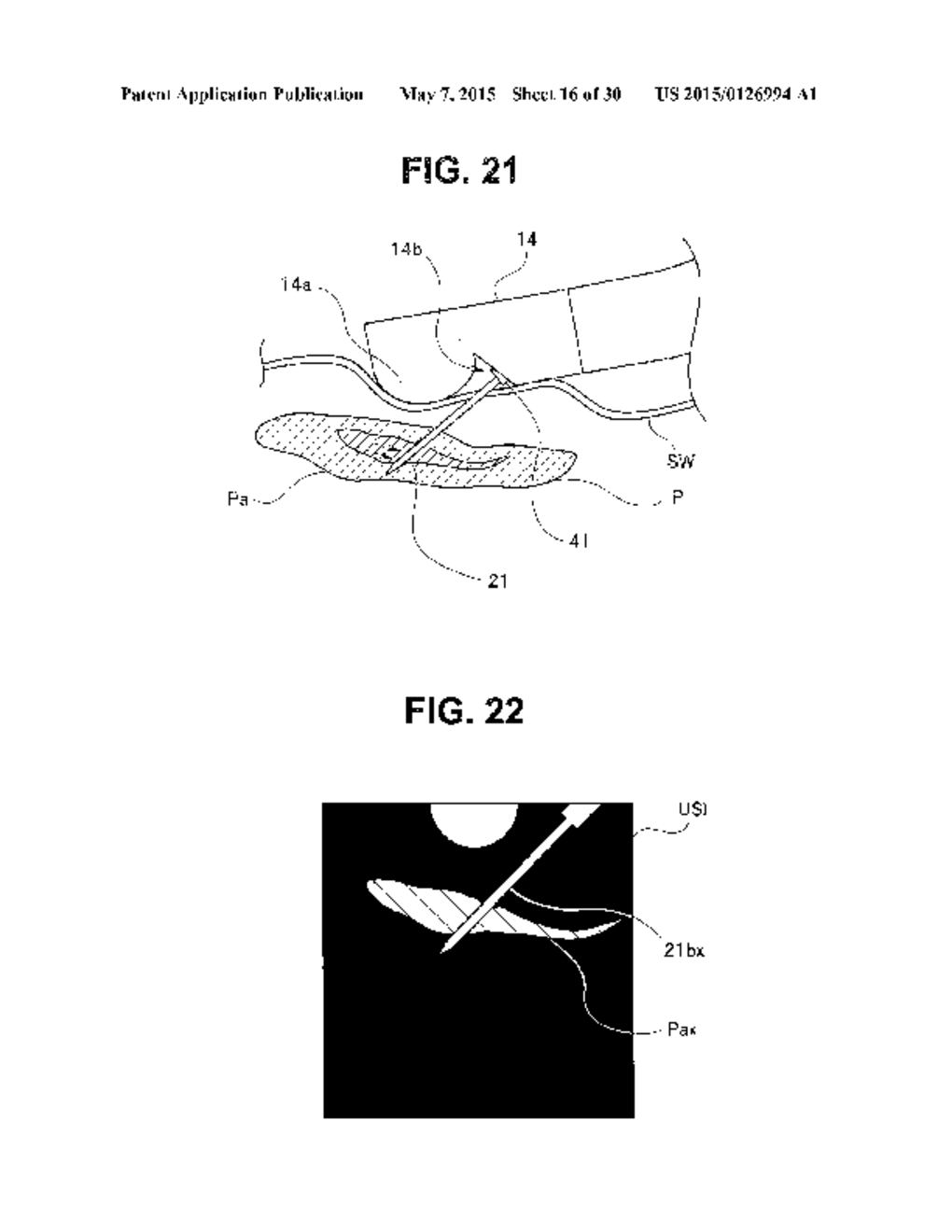 PUNCTURE TOOL AND ULTRASOUND ENDOSCOPE - diagram, schematic, and image 17