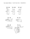 FLEXIBLE ACL INSTRUMENTATION, KIT AND METHOD diagram and image