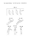 FLEXIBLE ACL INSTRUMENTATION, KIT AND METHOD diagram and image