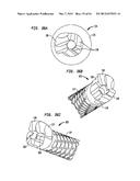 FLEXIBLE ACL INSTRUMENTATION, KIT AND METHOD diagram and image