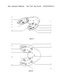 REPLACEABLE SUTURING HEAD, A REPLACEABLE NEEDLE CARTRIDGE, AND A SUTURING     DEVICE diagram and image