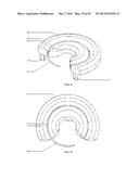 REPLACEABLE SUTURING HEAD, A REPLACEABLE NEEDLE CARTRIDGE, AND A SUTURING     DEVICE diagram and image