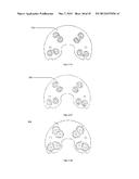 REPLACEABLE SUTURING HEAD, A REPLACEABLE NEEDLE CARTRIDGE, AND A SUTURING     DEVICE diagram and image