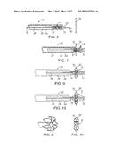 DEVICE AND METHOD FOR ESTABLISHING AN ARTIFICIAL ARTERIO-VENOUS FISTULA diagram and image