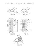 DEVICE AND METHOD FOR ESTABLISHING AN ARTIFICIAL ARTERIO-VENOUS FISTULA diagram and image