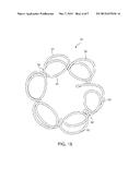 DEVICE AND METHOD FOR ESTABLISHING AN ARTIFICIAL ARTERIO-VENOUS FISTULA diagram and image