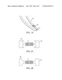 DEVICE AND METHOD FOR ESTABLISHING AN ARTIFICIAL ARTERIO-VENOUS FISTULA diagram and image