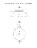 BALLOON CATHETER WITH LITHOTRIPSY AMPLIFICATION SYSTEM diagram and image