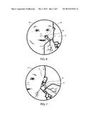 DEVICE FOR EXTRACTING DRIED NASAL MUCUS OR EARWAX diagram and image