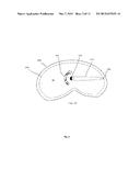 System and Method for Control and Monitoring of Conformal Thermal Therapy diagram and image