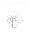 MECHANICAL METHOD AND APPARATUS FOR SEQUENTIAL TISSUE FASTENING diagram and image