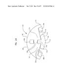 MECHANICAL METHOD AND APPARATUS FOR SEQUENTIAL TISSUE FASTENING diagram and image